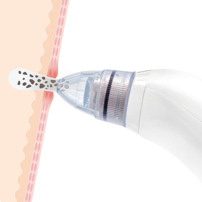 Innovagoods Elektrische Meeeter Gezichtsreiniger Pore·off Innovagoods